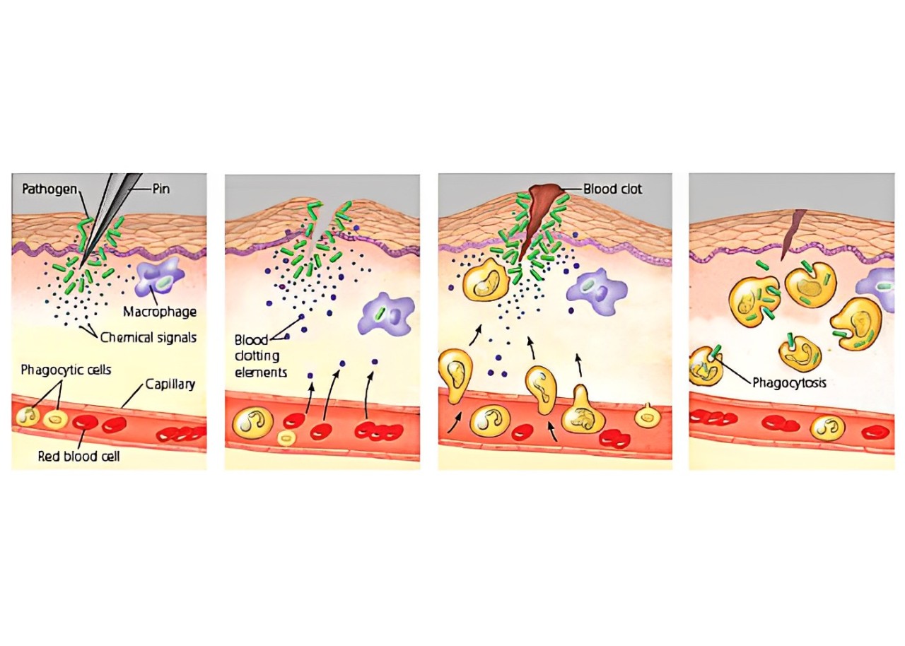 Bekam Keradangan: Rawatan Alternatif untuk Mengurangkan Inflamasi 2